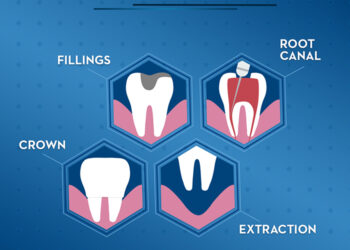 No More Fear: Scientists Find a Way to Stop Tooth Decay Without Drilling